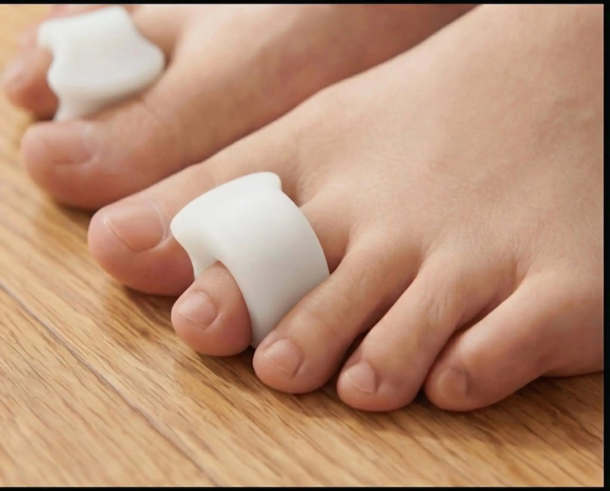 SplayForce™ Toe Spacer — Complete Protocol - SplayForce™